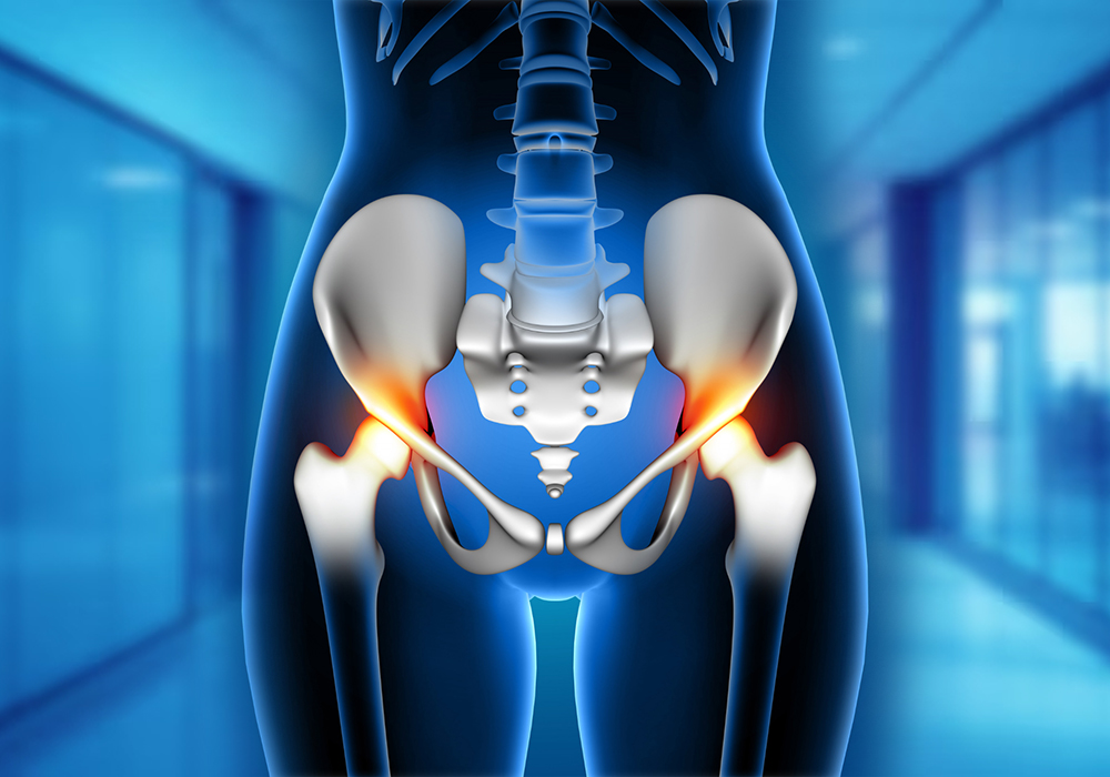 What Is ACL Reconstruction?