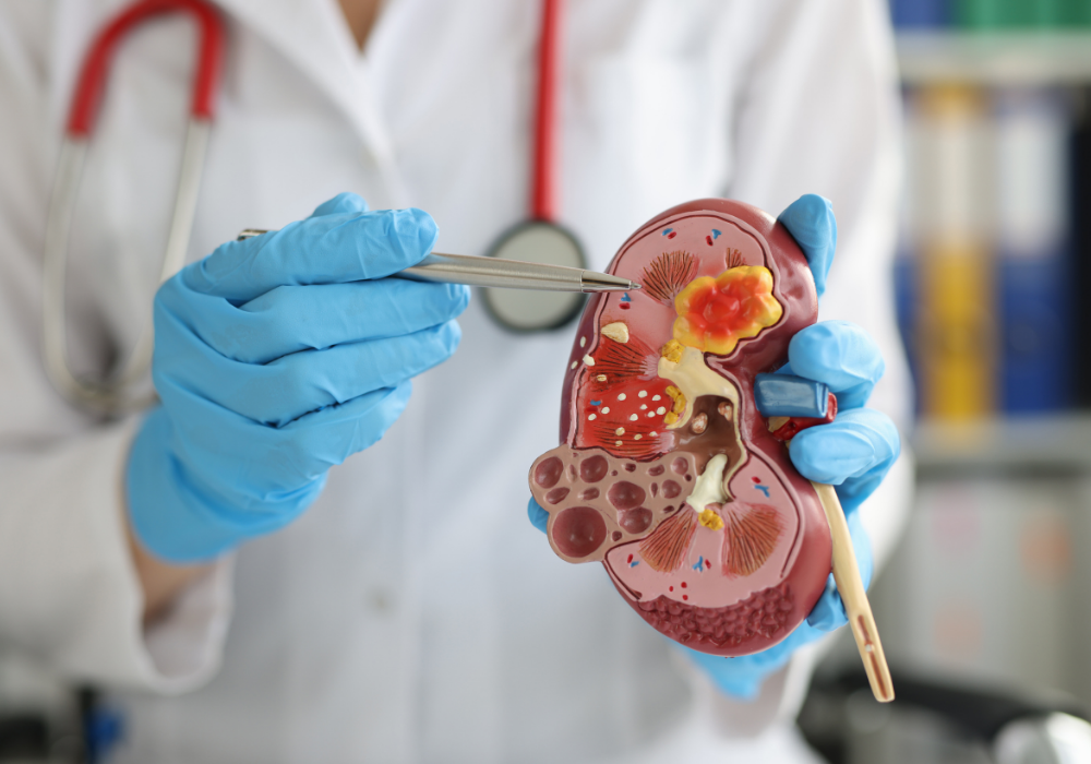 urology hospital chennai