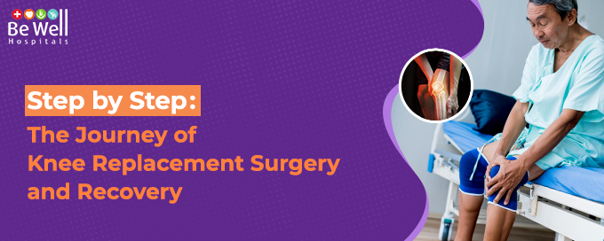 Step by Step: The Journey of Knee Replacement Surgery and Recovery