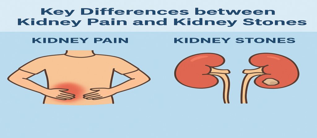 How to Know If It’s Kidney Stone or Kidney Pain – A Complete Guide Differences - Kidney Pain - Kidney Stones